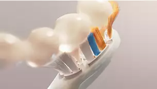 Состояние десен в 15 раз лучше всего за шесть недель